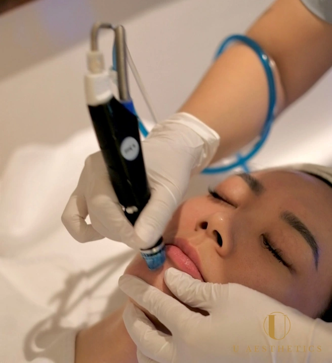 HydraFacial versus CO2 facial Singapore