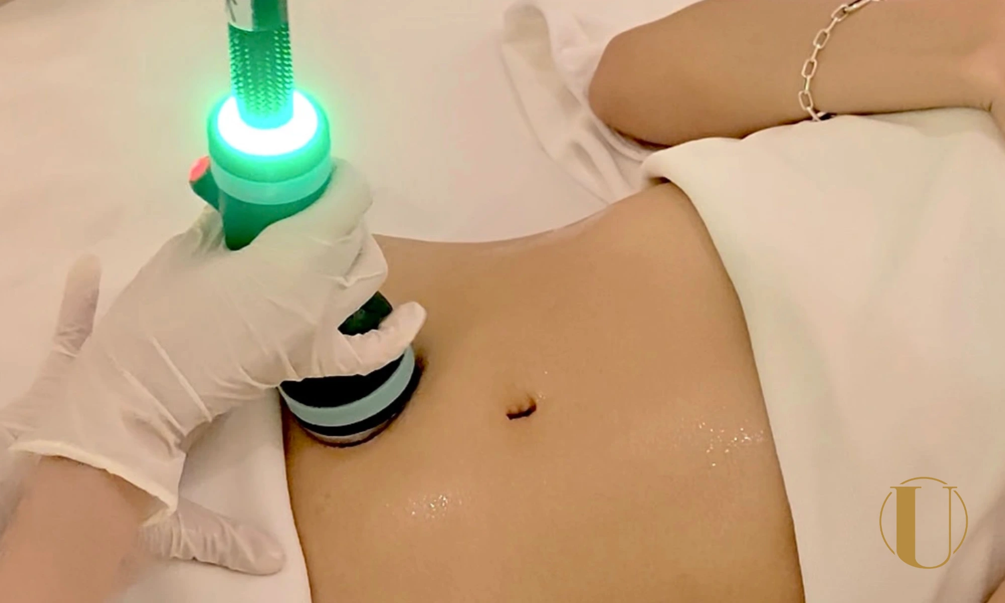Onda Pro Coolwaves non-surgical slimming treatment in Singapore for stubborn fat