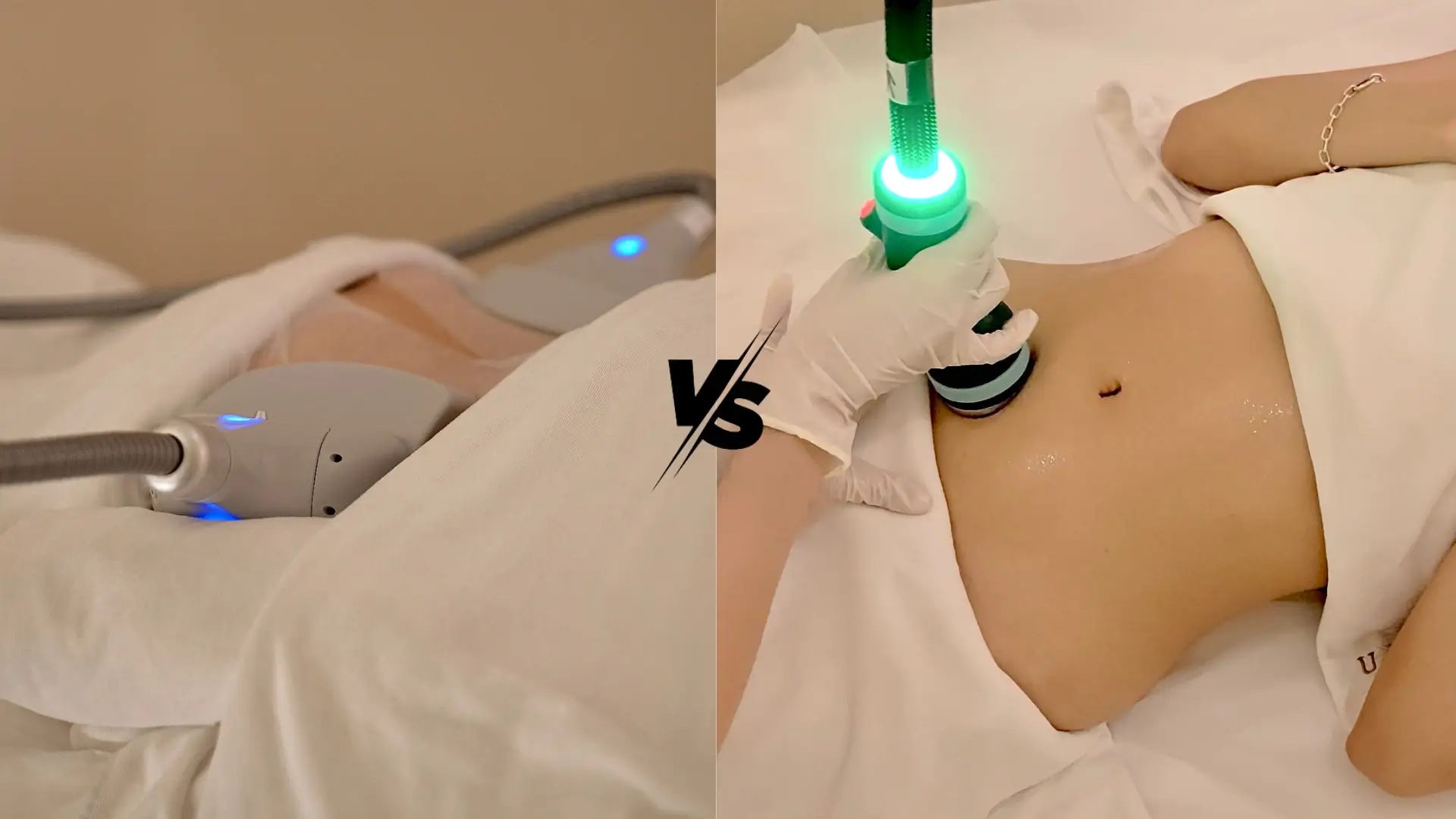 Onda Pro vs CoolSculpting in Singapore: Which Treatment Is Better?