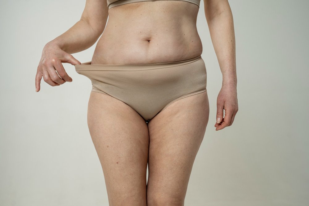 Loose Skin